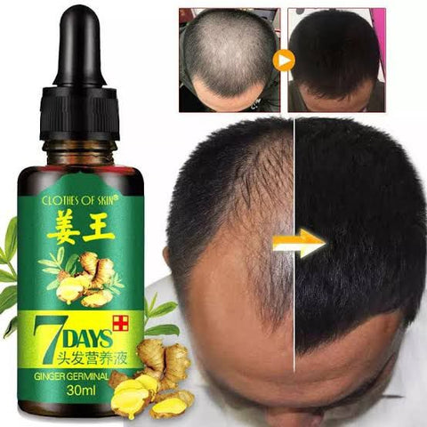 Hair Growth Germinal Serum Oil (30ml)