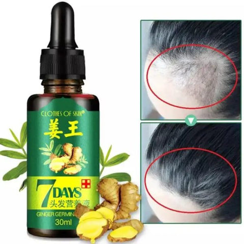 Hair Growth Germinal Serum Oil (30ml)