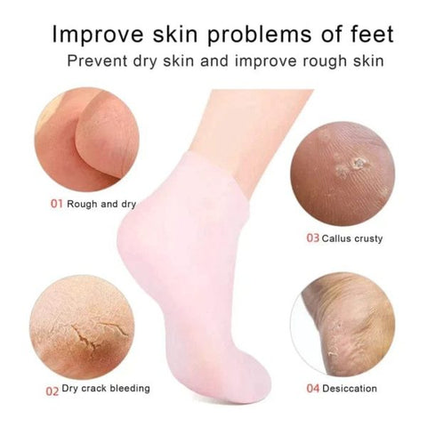 Silicone Jelly Socks | Gel Moisturizing Socks | Foot Care Protector