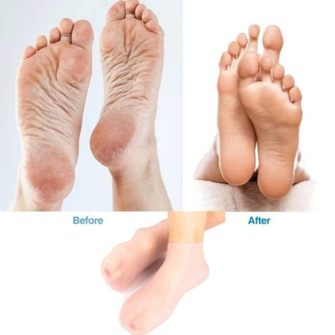 Silicone Jelly Socks | Gel Moisturizing Socks | Foot Care Protector